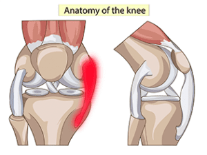 Causes Symptoms Of Knee Pain How To Treat Them